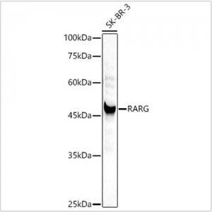 KD-Validated RARG Rabbit pAb (20 μl)