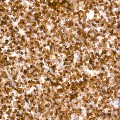 KD-Validated Bcl-2 Rabbit mAb (20 μl)