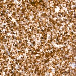 KD-Validated Bcl-2 Rabbit mAb (20 μl)