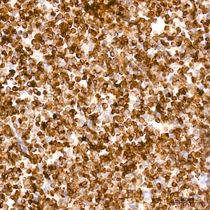 KD-Validated Bcl-2 Rabbit mAb (20 μl)