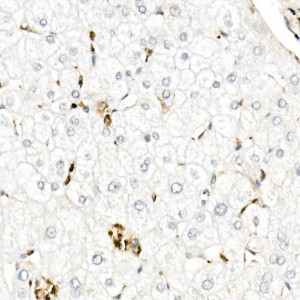 KD-Validated Gelsolin Rabbit pAb (20 μl)