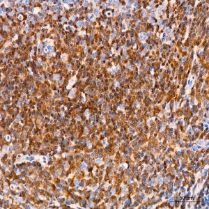 KO-Validated Smad3 Rabbit mAb (20 μl)