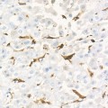 KD-Validated Gelsolin Rabbit mAb (20 μl)