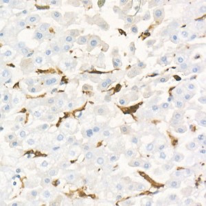 KD-Validated Gelsolin Rabbit mAb (20 μl)
