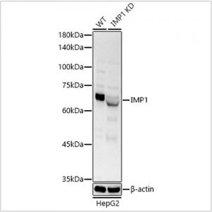 KO-Validated IGF2BP1/IMP1 Rabbit pAb (20 μl)