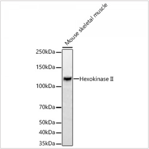 KO-Validated Hexokinase II Rabbit mAb (20 μl)