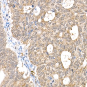 KO-Validated Smad1 Rabbit mAb (20 μl)