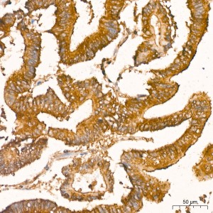 KO-Validated NF-kB p65/RelA Rabbit mAb (20 μl)