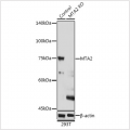 KO-Validated MTA2 Rabbit pAb (20 μl)