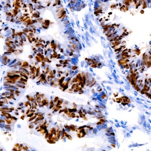 KO-Validated p53 Rabbit mAb (20 μl)