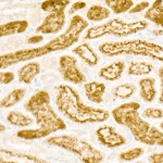 KD-Validated RHOT1/MIRO1 Rabbit mAb (20 μl)