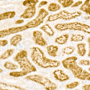 KD-Validated RHOT1/MIRO1 Rabbit mAb (20 μl)