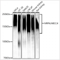 KD-Validated MRP4/ABCC4 Rabbit mAb (20 μl)