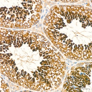 KO-Validated LKB1 Rabbit mAb (20 μl)