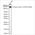 KD-Validated Integrin alpha 5 (ITGA5/CD49e) Rabbit mAb (20 μl)
