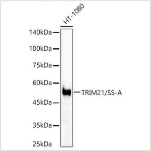 KO-Validated TRIM21/SS-A Rabbit mAb (20 μl)
