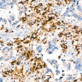 KD-Validated PSAP Rabbit mAb (20 μl)
