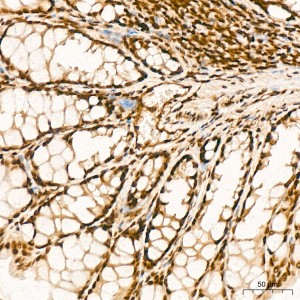 KD-Validated YTHDC1 Rabbit mAb (20 μl)