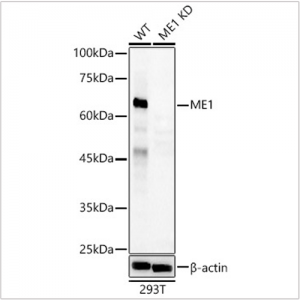 KD-Validated ME1 Rabbit pAb (20 μl)