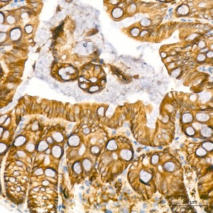 KO-Validated KRAS Rabbit mAb (20 μl)