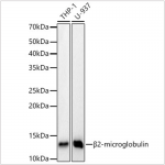 KD-Validated beta 2 Microglobulin Rabbit mAb (20 μl)