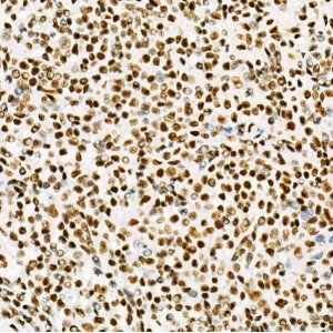 KD-Validated USF1 Rabbit mAb (20 μl)