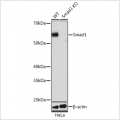KO-Validated Smad1 Rabbit mAb (20 μl)