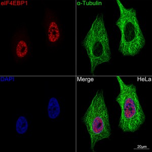 KD-Validated eIF4EBP1 Rabbit mAb (20 μl)