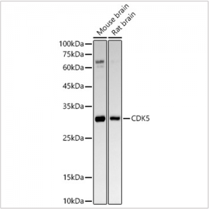 KO-Validated CDK5 Rabbit mAb (20 μl)
