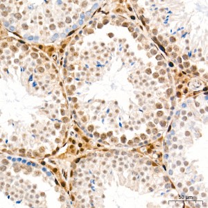 KO-Validated CDK4 Rabbit PolymAb® (20 μl)