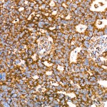 KD-Validated Bak Rabbit mAb (20 μl)