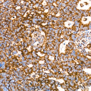 KD-Validated Bak Rabbit mAb (20 μl)