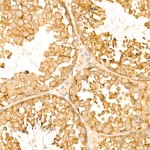 KD-Validated TOLLIP Rabbit mAb (20 μl)
