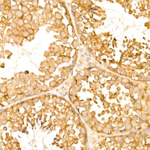 KD-Validated TOLLIP Rabbit mAb (20 μl)