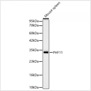 KD-Validated PHF11 Rabbit mAb (20 μl)