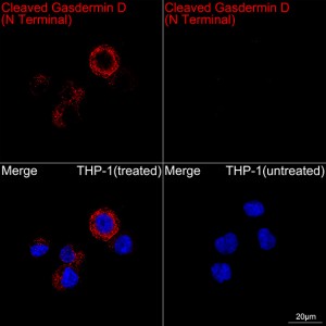 KO-Validated Cleaved Gasdermin D (N Terminal) Rabbit mAb (20 μl)