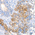 KO-Validated βIII-Tubulin Rabbit mAb (20 μl)