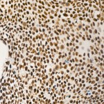 KO-Validated PCIF1 Rabbit mAb (20 μl)