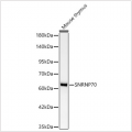 KD-Validated SNRNP70 Rabbit mAb (20 μl)