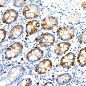 KD-Validated Thymidylate synthase Rabbit mAb (20 μl)