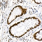 KD-Validated METTL14 Rabbit mAb (20 μl)