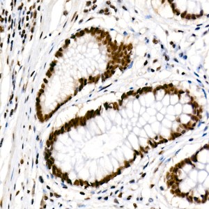 KD-Validated METTL14 Rabbit mAb (20 μl)