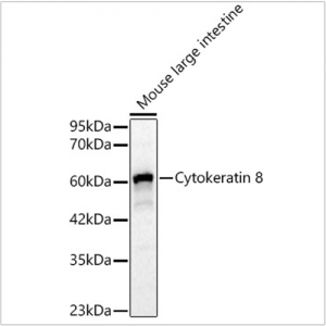 KO-Validated Cytokeratin 8 Rabbit pAb (20 μl)