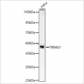 KO-Validated TRIM21/SS-A Rabbit mAb (20 μl)
