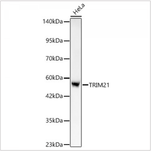 KO-Validated TRIM21/SS-A Rabbit mAb (20 μl)