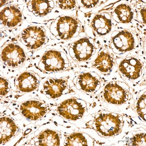 KD-Validated PSMA7 Rabbit mAb (20 μl)