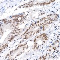 KD-Validated ZNF143 Rabbit mAb (20 μl)
