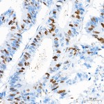 KD-Validated RGAP1 Rabbit mAb (20 μl)