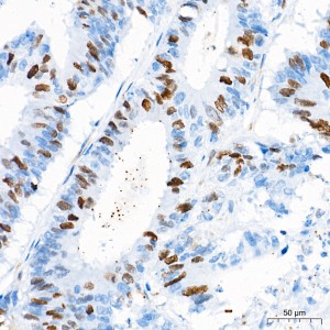 KD-Validated RGAP1 Rabbit mAb (20 μl)