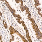 KD-Validated TIMM10 Rabbit mAb (20 μl)